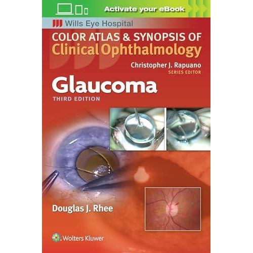 Glaucoma (Color Atlas and Synopsis of Clinical Ophthalmology) ,Ed. :3
