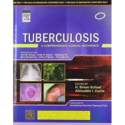 Tuberculosis. India ,Ed. :1