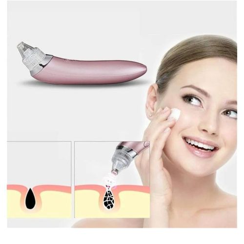 USB Rechargeable Blackhead Remover Vacuum Facial Pore Cleaner with 4 Suction Heads