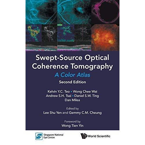 Swept-Source Optical Coherence Tomography: A Color Atlas (Second Edition) ,Ed. :2