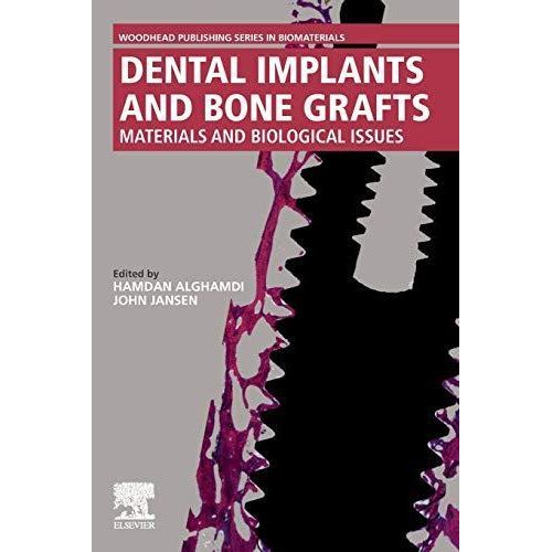 Dental Implants and Bone Grafts: Materials and Biological Issues
