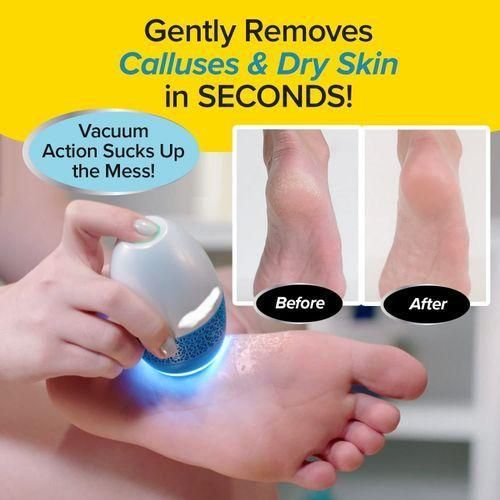 Electric foot scrubber for dead skin and cracked heels
