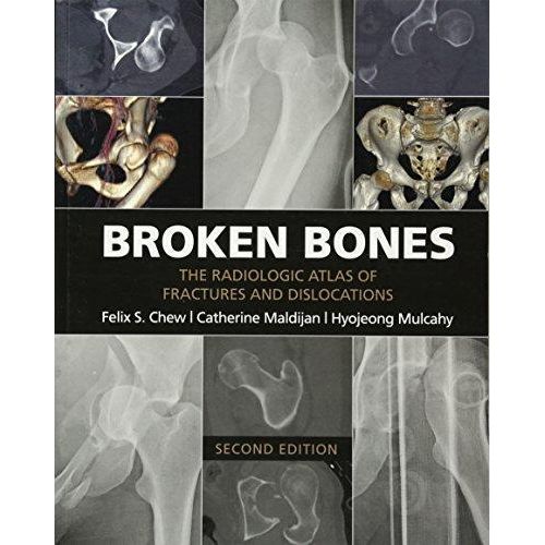 Broken Bones: The Radiologic Atlas of Fractures and Dislocations ,Ed. :2