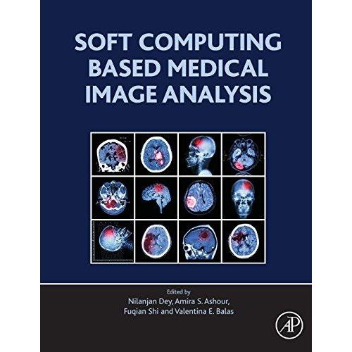 Soft Computing Based Medical Image Analysis ,Ed. :1