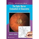 Williams The Optic Nerve Evaluation In Glaucoma: An Interactive Workbook