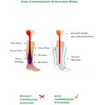 product_image_name-Generic-شراب لعلاج دوالي تحت الركبة من فينوسان 6000، XXL-3