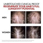 product_image_name-Dercos-سيروم فيشي ديركوس أمينيكسيل كلينيكال R.E.G.E.N لتعزيز نمو الشعر وكثافته - 90 مل-3