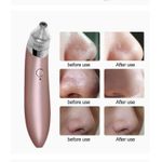 product_image_name-Generic-جهاز إزالة الرؤوس السوداء وتنظيف البشرة-2