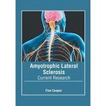 Amyotrophic Lateral Sclerosis: Current Research