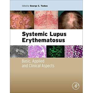 Systemic Lupus Erythematosus: Basic, Applied and Clinical Aspects ,Ed. :1