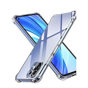 متوافق مع هاتف Xiaomi Mi 11 Lite 5G، جراب شفاف مقاوم للخدش والصدمات، مصنوع من مادة TPU عالية الوضوح، بفتحات دقيقة وتصميم نحيف، مقاس 6.55 بوصة.