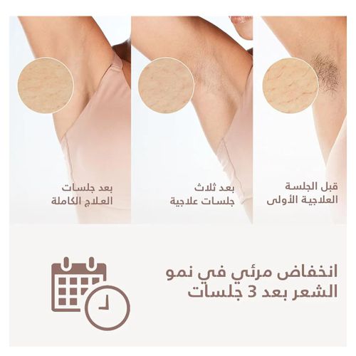 product_image_name-Philips-جهاز استشعار ذكي لازالة الشعر بالنبض الضوئي من سلسلة 9000 من لوميا،ة 4 ملحقات بلون ذهبي وردي/ابيض-3