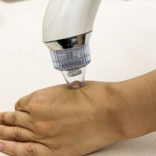 product_image_name-Generic-جهاز شفط الدهون والرؤوس السوداء من الوجه - ابيض-4