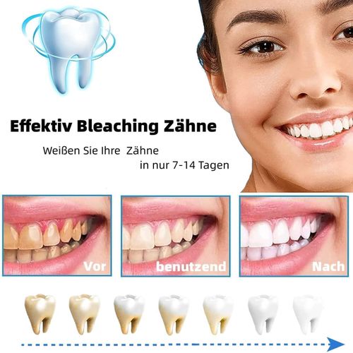 product_image_name-Generic-شرائط لتبييض الاسنان، شرائط تبييض الاسنان، سريعة التاثير، آمنة على المينا، 28 شريط للاسنان البيضاء ، ابتسم بثقة-3