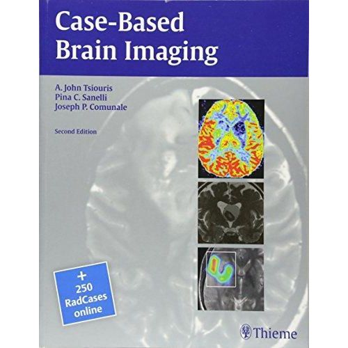 Jumia Book Case-Based Brain Imaging ,Ed. :2