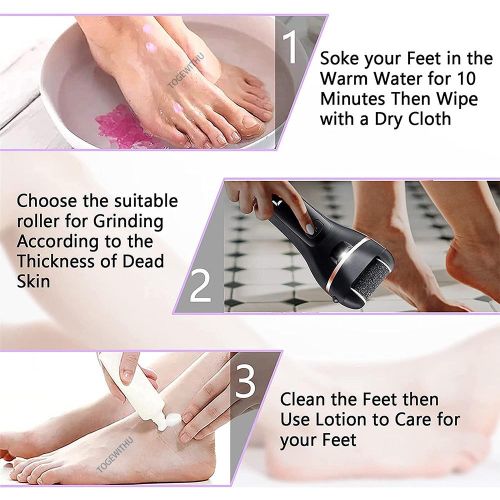 TOGEWITHU Electric Callus Remover For Feet, Rechargeable Foot Scrubber Foot  File Hard Skin Remover Pedicure Tools Set For Feet Waterproof Pedicure Kit  For Cracked Heels And Dead Skin With LED Light And