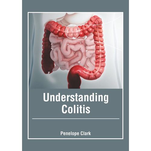 Generic Understanding Colitis