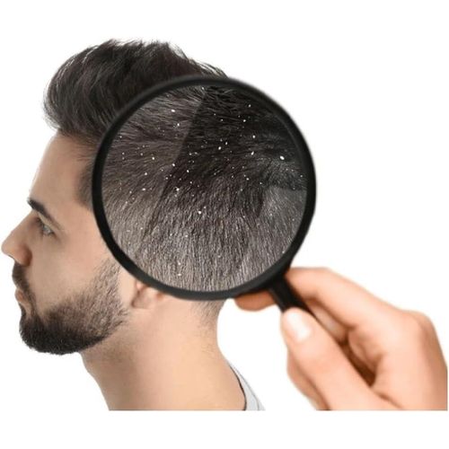 product_image_name-Hebatt Pharma-شامبو SANUS HAIR المضاد للقشرة 300 مل-5