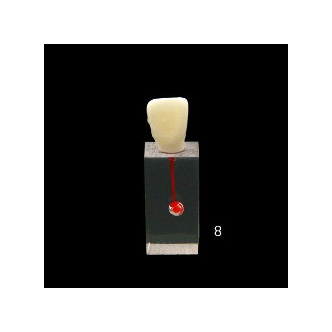 تسوق Dental Root Canal Block Teaching Model Endodontics Training Tooth ...