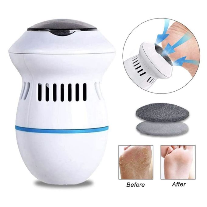 Pedi Vac by Ped Egg - Callus Remover for Feet with Built-in Vacuum Removes  Dead Skin from Feet with 2000 RPMs - Electric Callus Remover Sucks Up