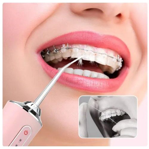 Oral high pressure water flosser